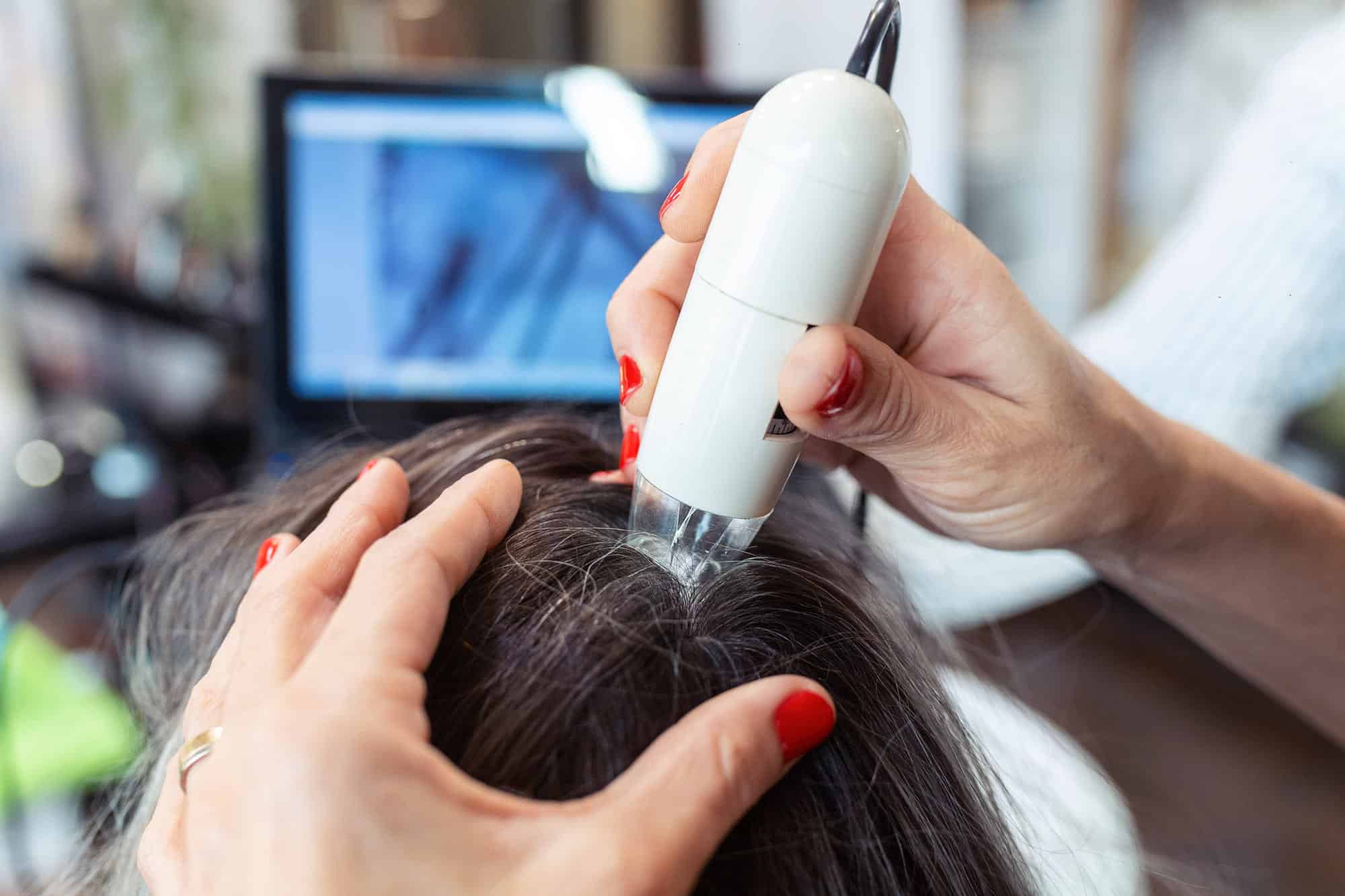 ¿Por qué se produce la caída de pelo estacional? | Toskani