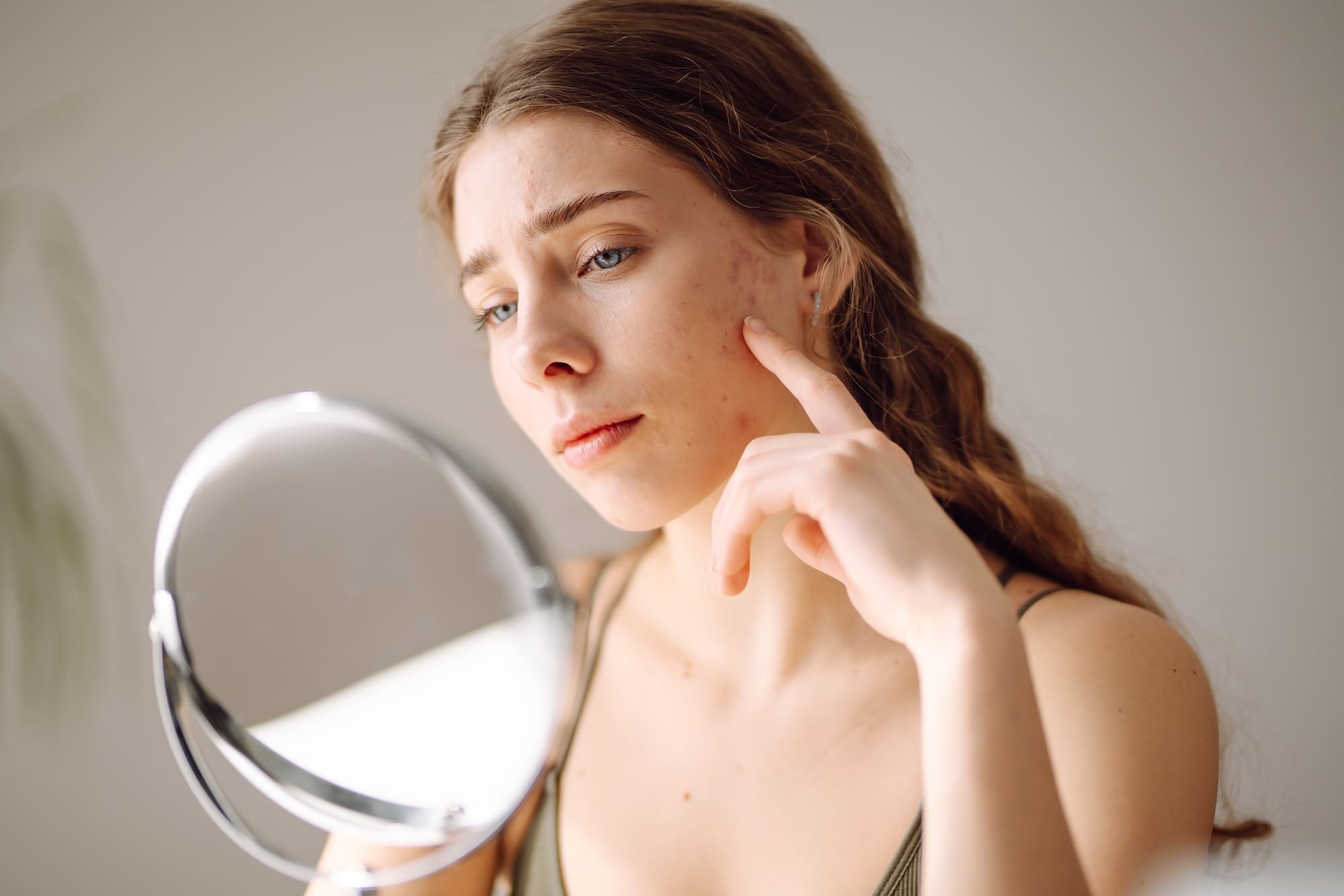 Cómo identificar los diferentes tipos de acne | Toskani